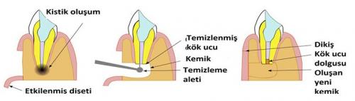 discekimi4_1.jpg